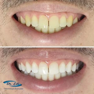 Sorrisos transformados que passaram por nossas mãos - imagem 1
