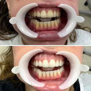 Sorrisos transformados que passaram por nossas mãos - imagem 10