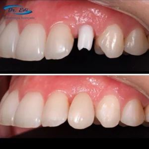Sorrisos transformados que passaram por nossas mãos - imagem 9