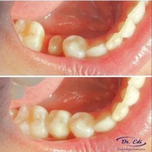 Sorrisos transformados que passaram por nossas mãos - imagem 11