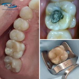 Sorrisos transformados que passaram por nossas mãos - imagem 10