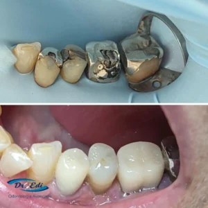Sorrisos transformados que passaram por nossas mãos - imagem 11
