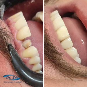Sorrisos transformados que passaram por nossas mãos - imagem 12