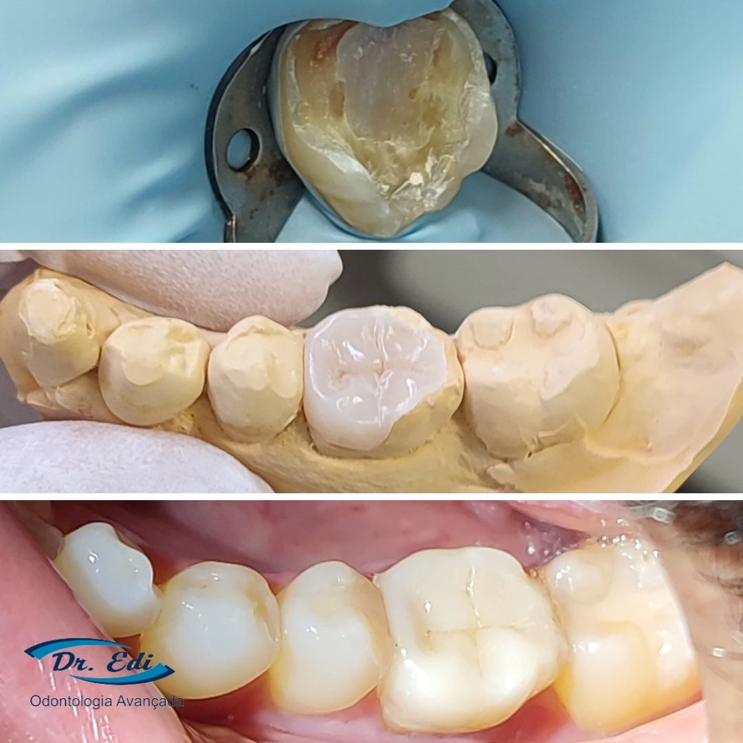 Sorrisos transformados que passaram por nossas mãos - imagem 14