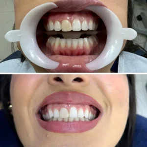 Sorrisos transformados que passaram por nossas mãos - imagem 11