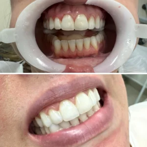 Sorrisos transformados que passaram por nossas mãos - imagem 12