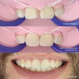 Sorrisos transformados que passaram por nossas mãos - imagem 12