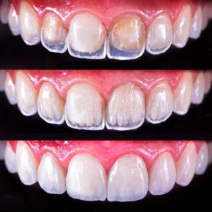 Sorrisos transformados que passaram por nossas mãos - imagem 13