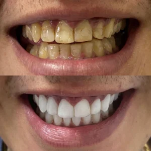Sorrisos transformados que passaram por nossas mãos - imagem 14