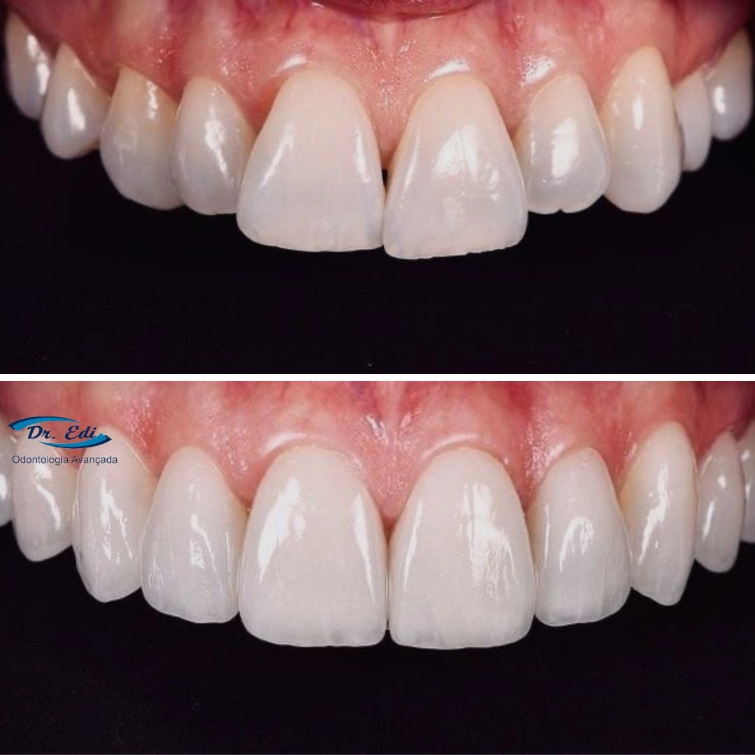 Sorrisos transformados que passaram por nossas mãos - imagem 18