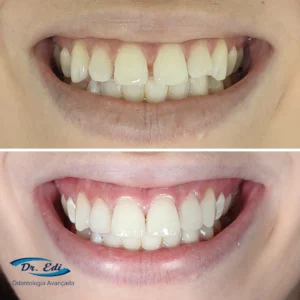 Sorrisos transformados que passaram por nossas mãos - imagem 19