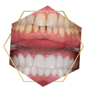 Sorrisos transformados que passaram por nossas mãos - imagem 16