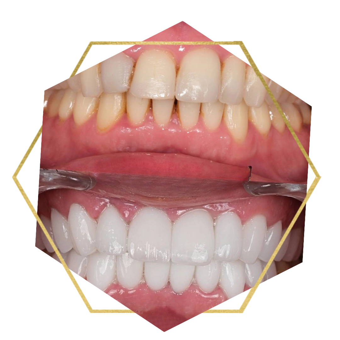 Sorrisos transformados que passaram por nossas mãos - imagem 17