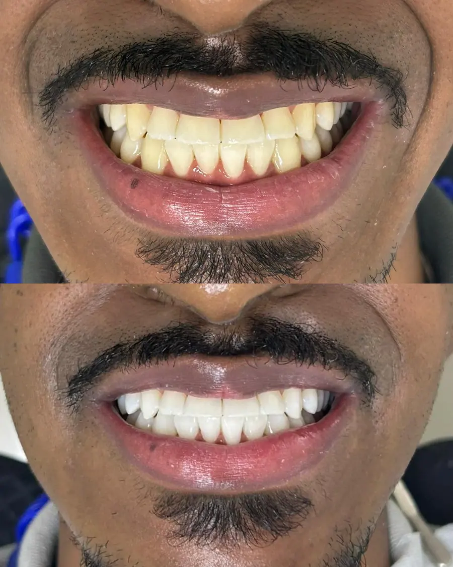 Sorrisos transformados que passaram por nossas mãos - imagem 3