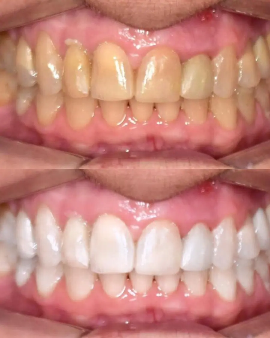 Sorrisos transformados que passaram por nossas mãos - imagem 4