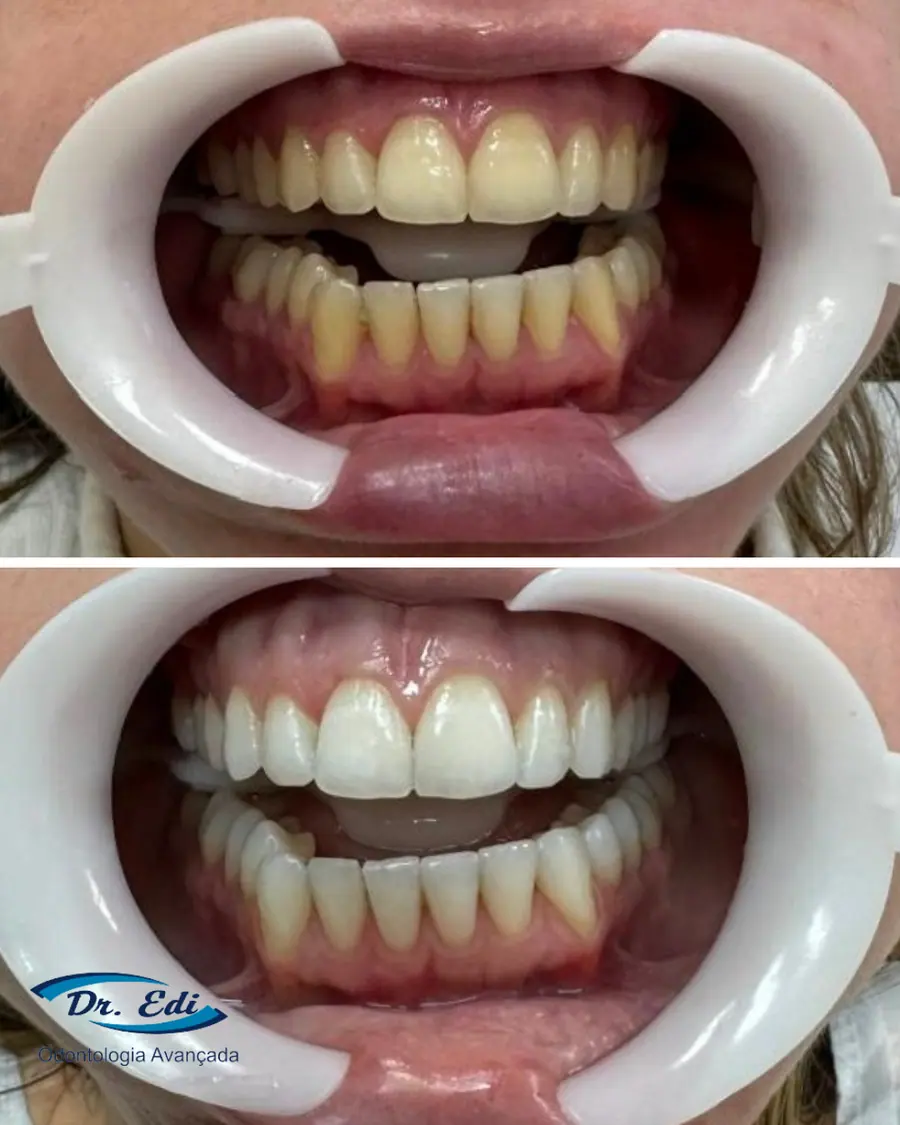 Sorrisos transformados que passaram por nossas mãos - imagem 5