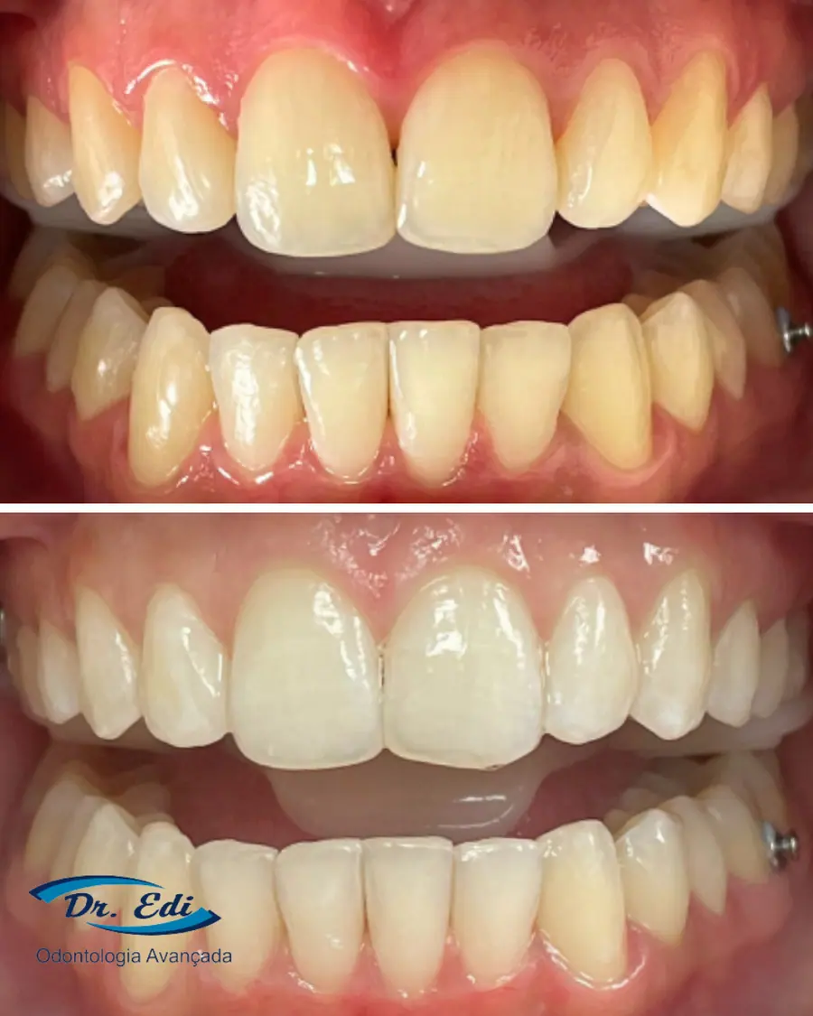Sorrisos transformados que passaram por nossas mãos - imagem 6
