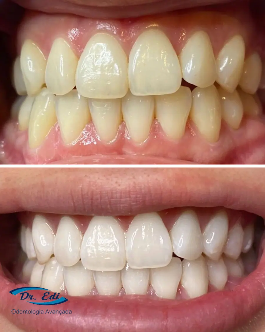 Sorrisos transformados que passaram por nossas mãos - imagem 7