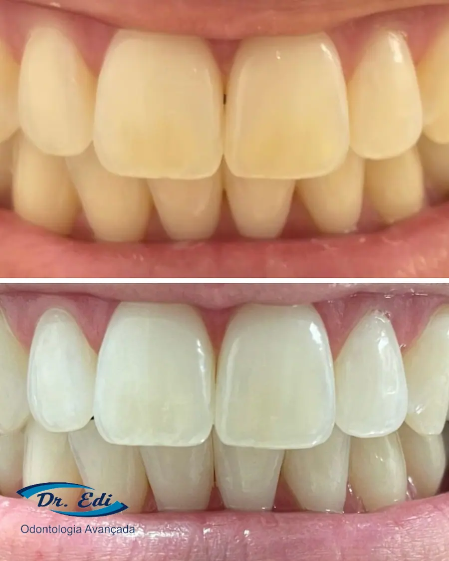 Sorrisos transformados que passaram por nossas mãos - imagem 8