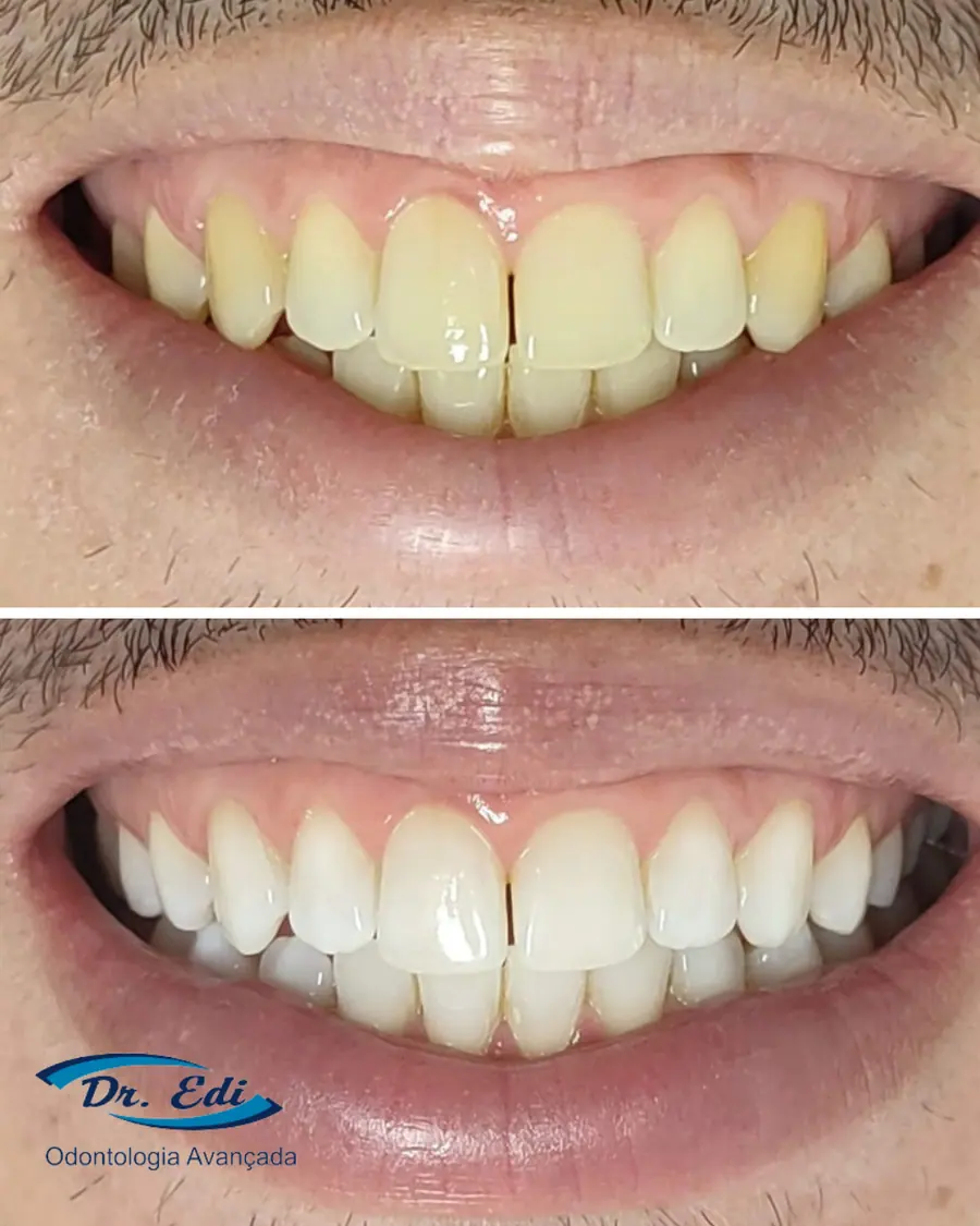 Sorrisos transformados que passaram por nossas mãos - imagem 9