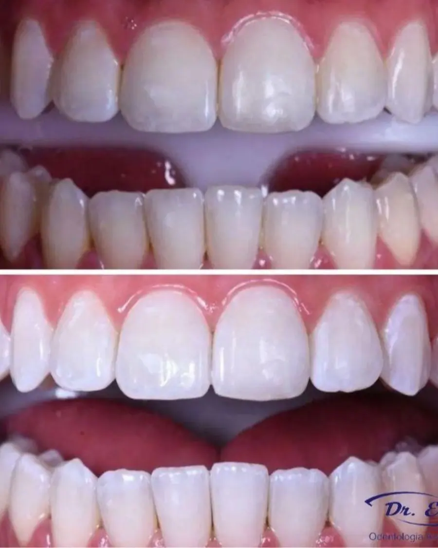 Sorrisos transformados que passaram por nossas mãos - imagem 10