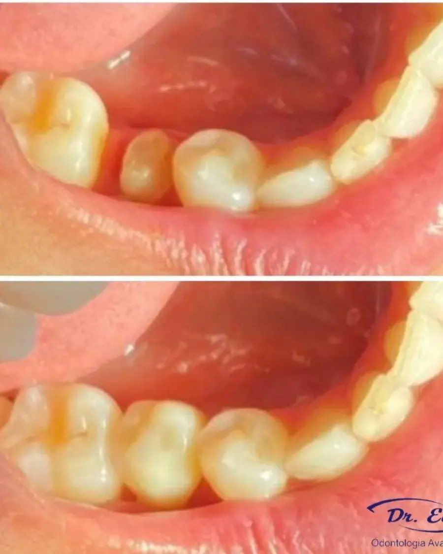 Sorrisos transformados que passaram por nossas mãos - imagem 3