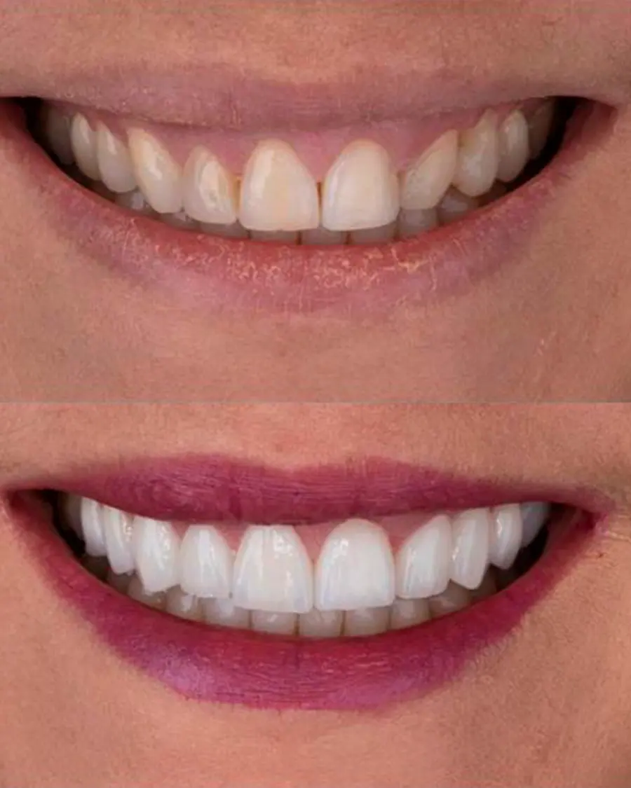Sorrisos transformados que passaram por nossas mãos - imagem 6