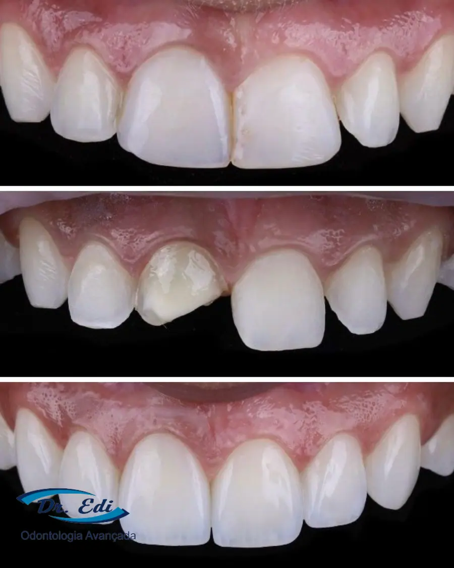 Sorrisos transformados que passaram por nossas mãos - imagem 7