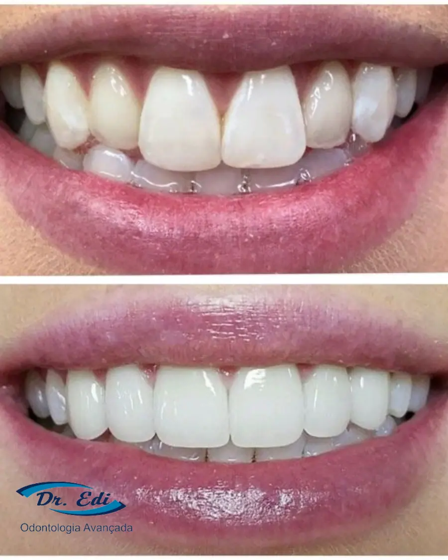 Sorrisos transformados que passaram por nossas mãos - imagem 8