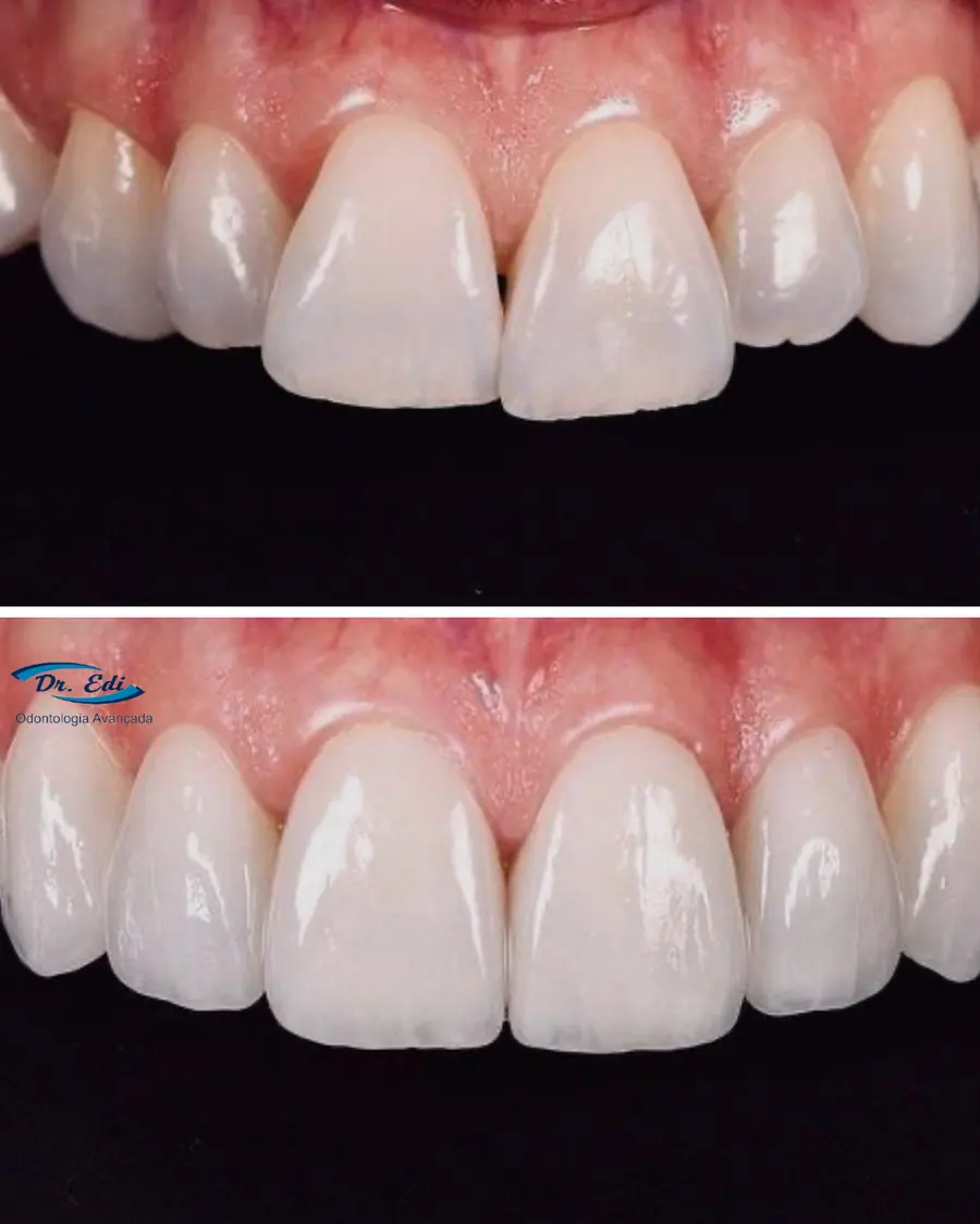 Sorrisos transformados que passaram por nossas mãos - imagem 9