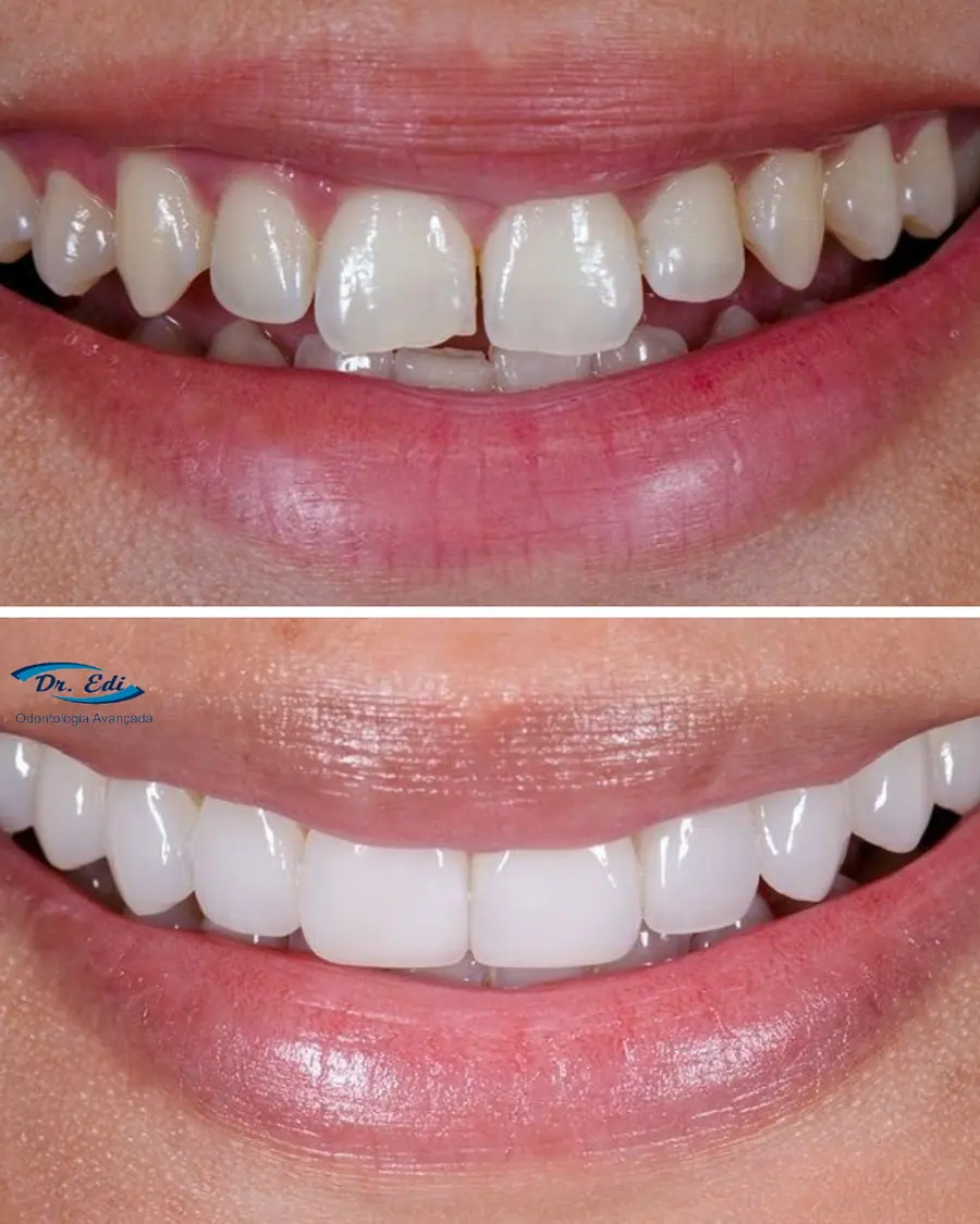 Sorrisos transformados que passaram por nossas mãos - imagem 10