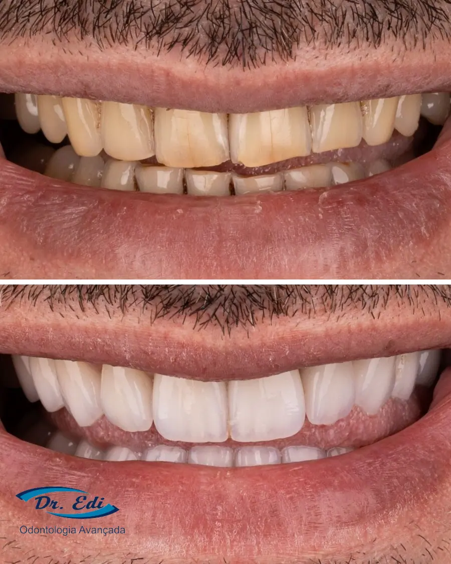 Sorrisos transformados que passaram por nossas mãos - imagem 11