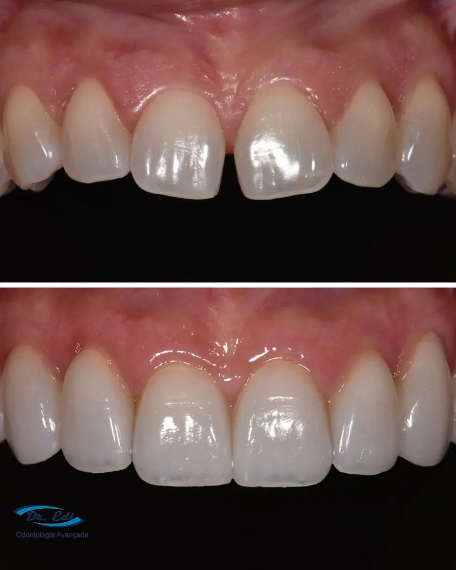 Sorrisos transformados que passaram por nossas mãos - imagem 12