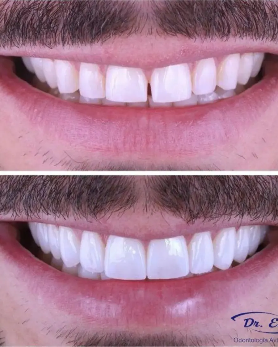 Sorrisos transformados que passaram por nossas mãos - imagem 15