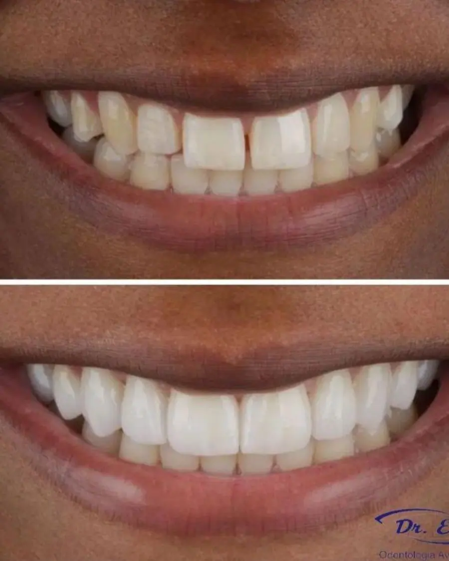 Sorrisos transformados que passaram por nossas mãos - imagem 16