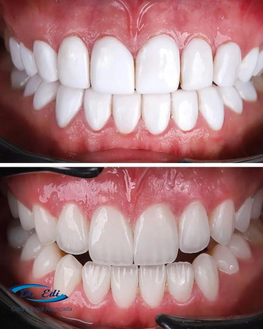 Sorrisos transformados que passaram por nossas mãos - imagem 17