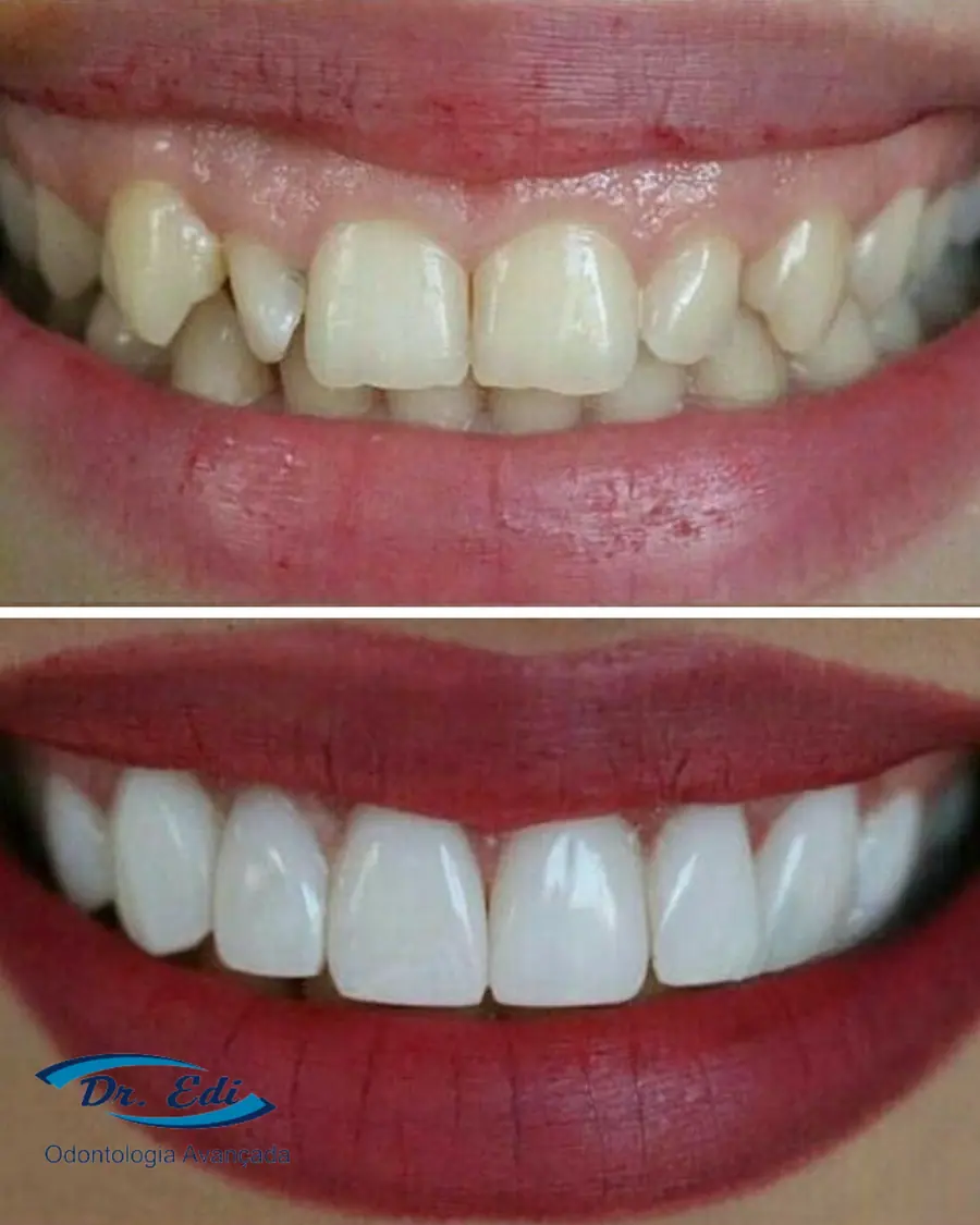 Sorrisos transformados que passaram por nossas mãos - imagem 18