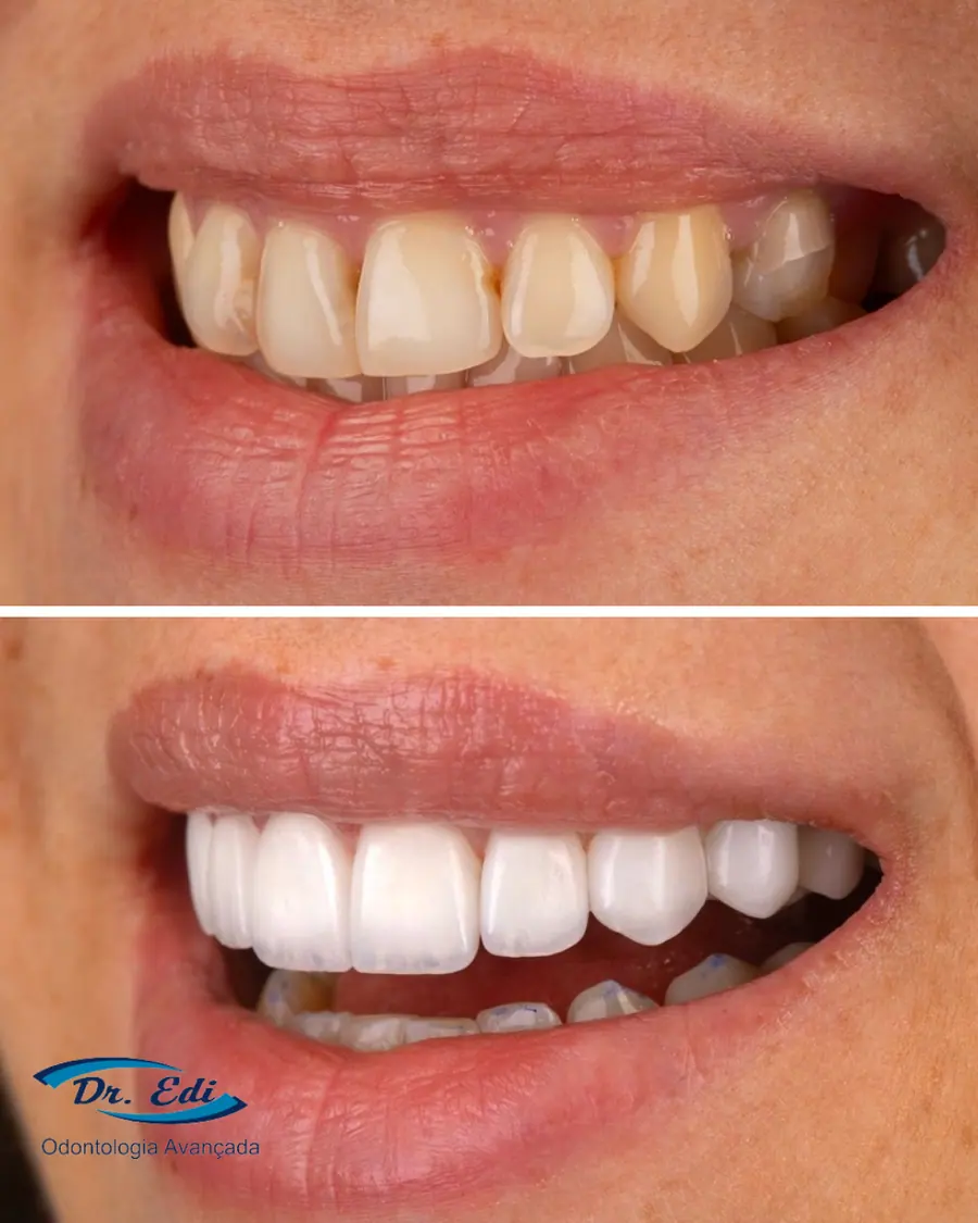 Sorrisos transformados que passaram por nossas mãos - imagem 19