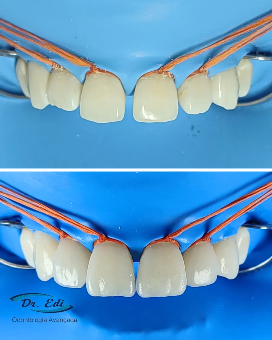 Sorrisos transformados que passaram por nossas mãos - imagem 20