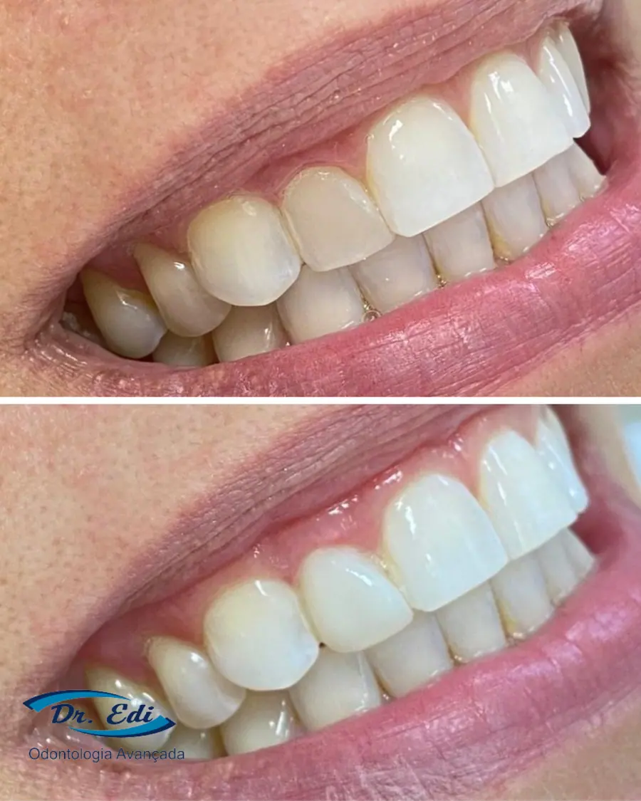 Sorrisos transformados que passaram por nossas mãos - imagem 21