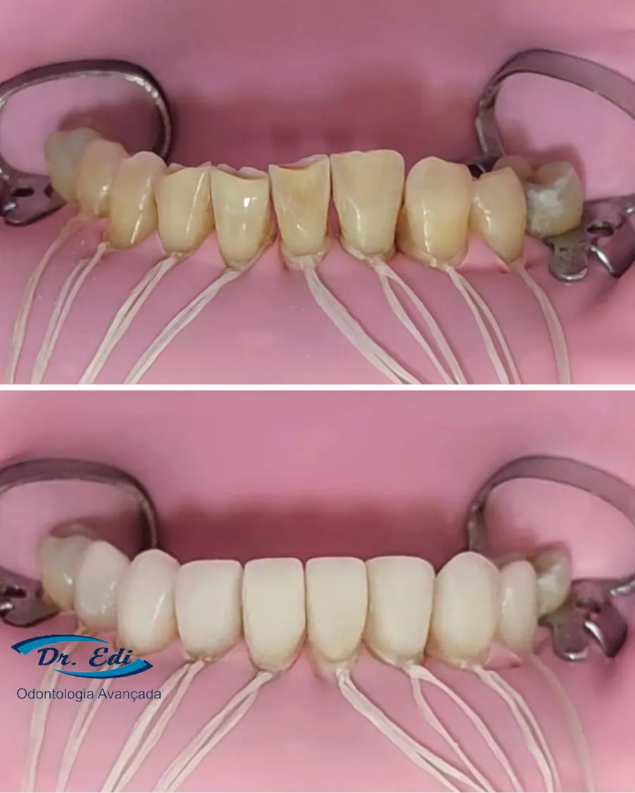 Sorrisos transformados que passaram por nossas mãos - imagem 22
