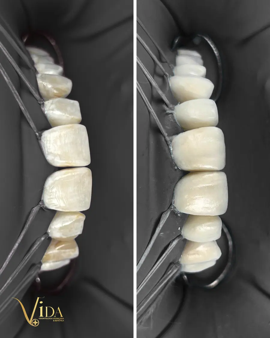 Sorrisos transformados que passaram por nossas mãos - imagem 23