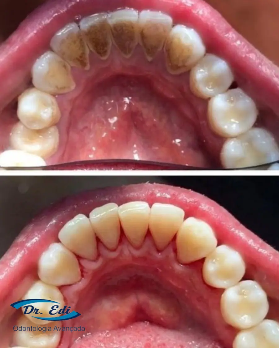 Sorrisos transformados que passaram por nossas mãos - imagem 3