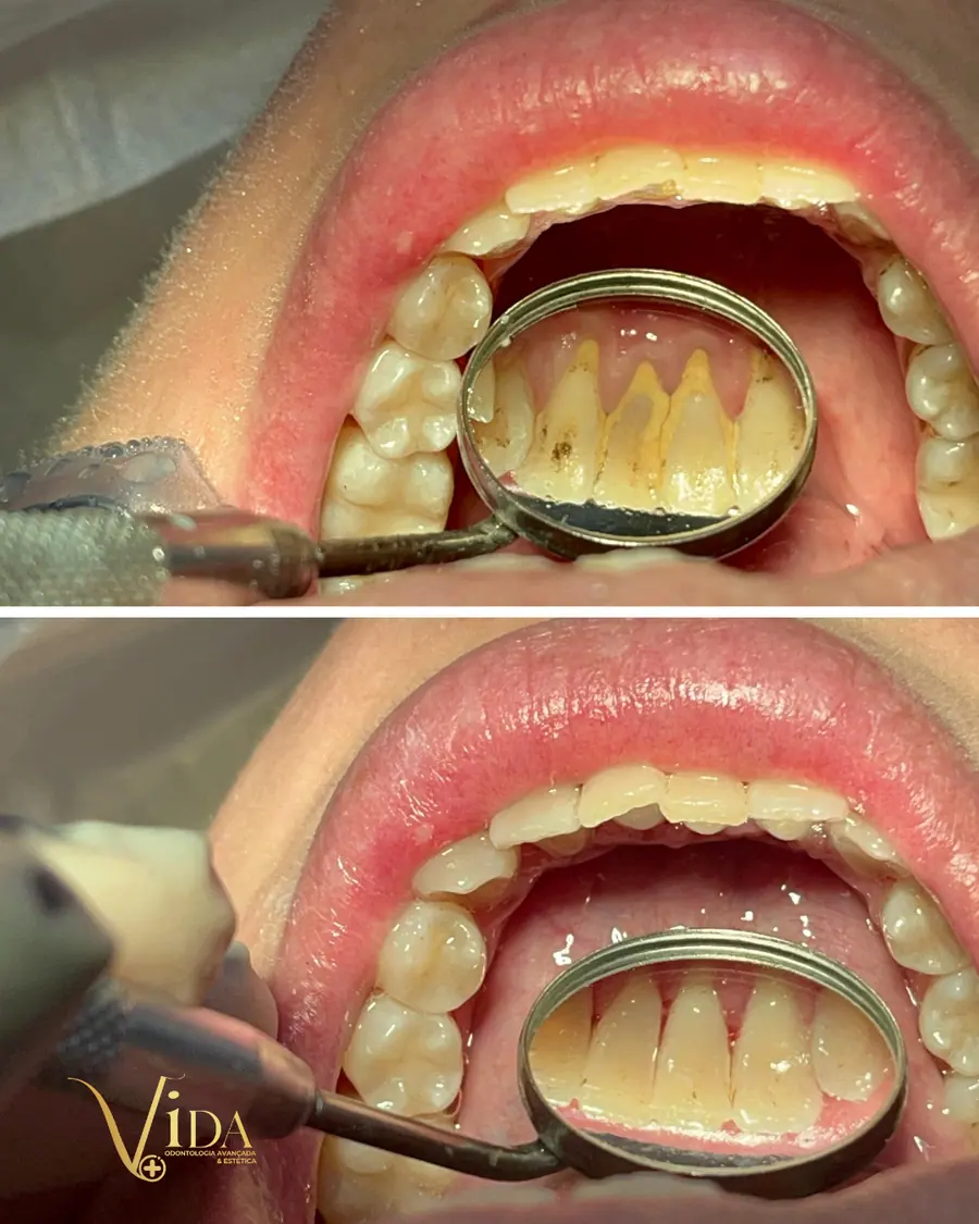 Sorrisos transformados que passaram por nossas mãos - imagem 4