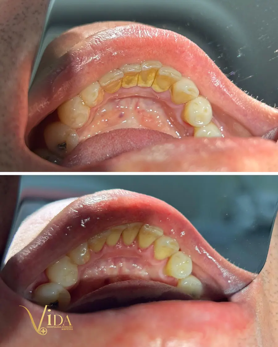 Sorrisos transformados que passaram por nossas mãos - imagem 6