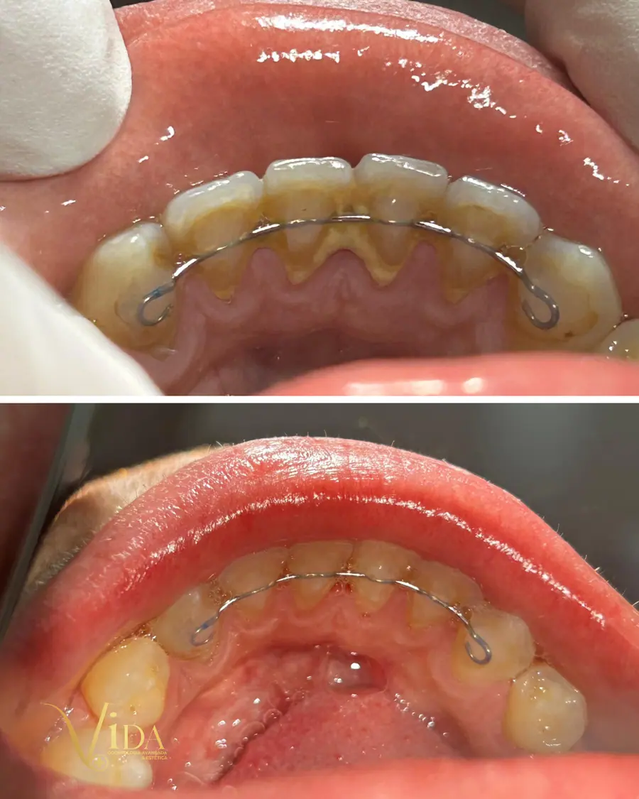 Sorrisos transformados que passaram por nossas mãos - imagem 8