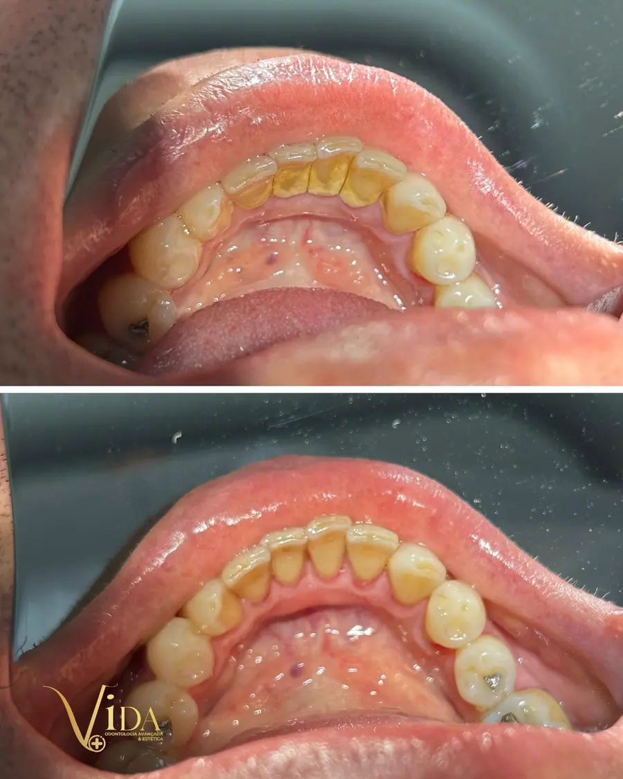 Sorrisos transformados que passaram por nossas mãos - imagem 9