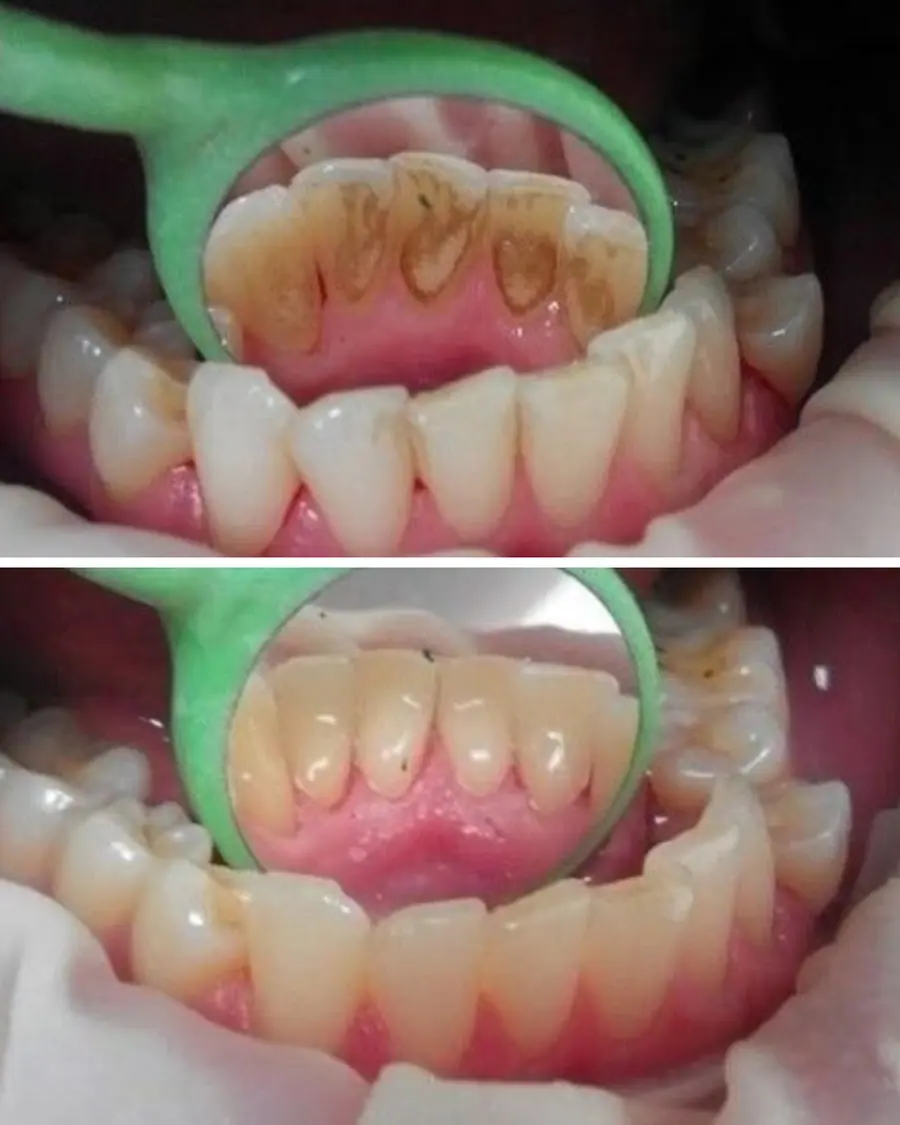 Sorrisos transformados que passaram por nossas mãos - imagem 10