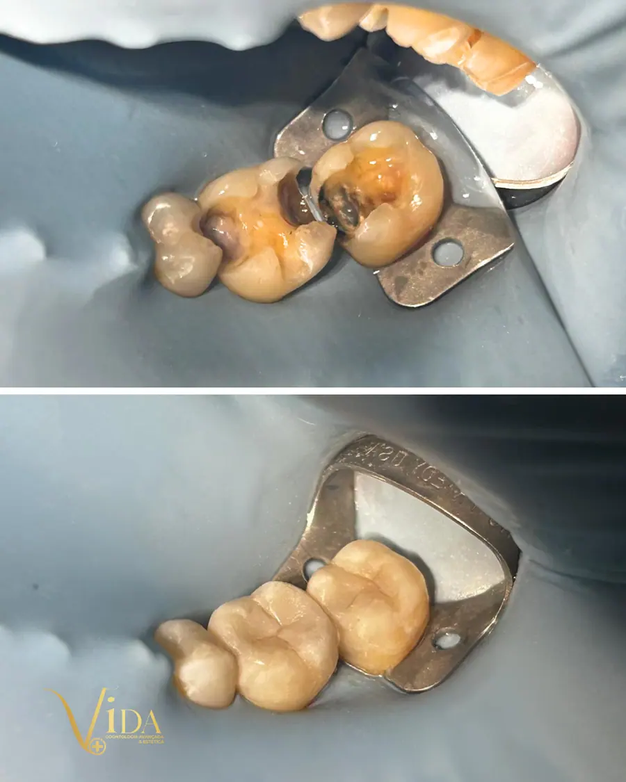 Sorrisos transformados que passaram por nossas mãos - imagem 16