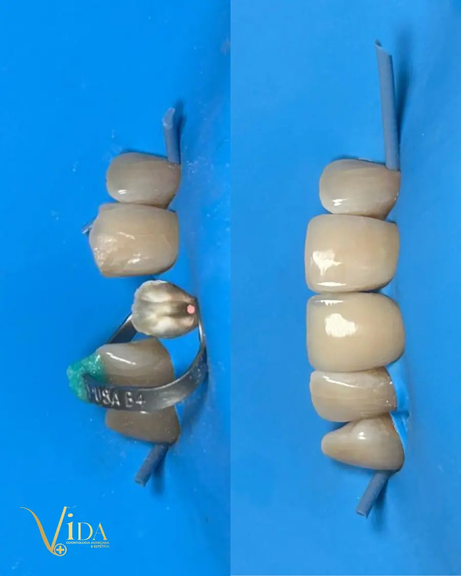 Sorrisos transformados que passaram por nossas mãos - imagem 17
